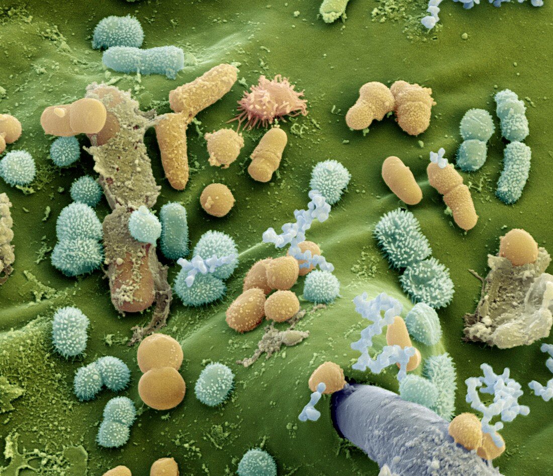 Bakterien auf Blattlaus 10kx - Bakterien auf einer Blattlaus 10 000-1