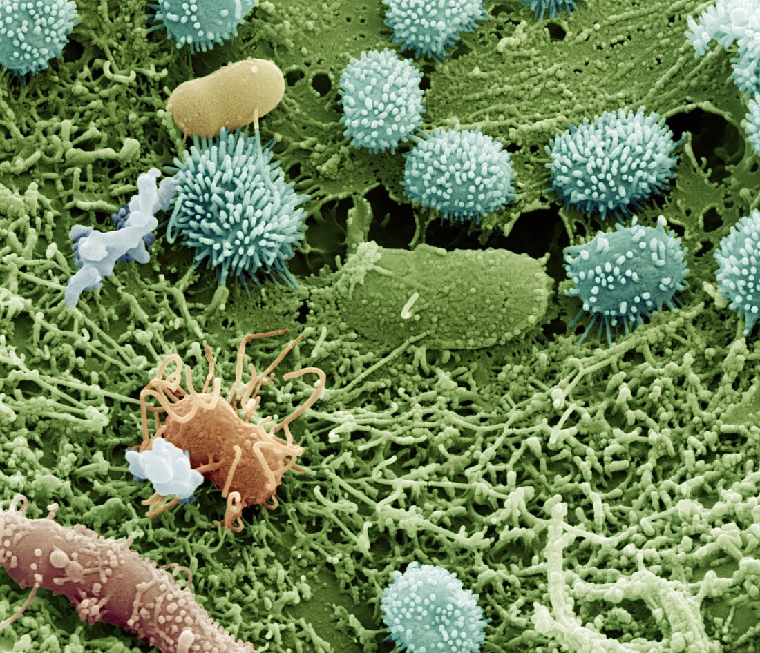 Bakterien auf Blattlaus 20kx - Bakterien auf einer Blattlaus 20 000-1