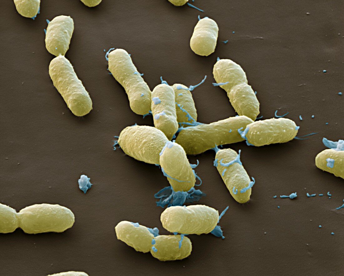 Yersinia pestis 20kx - Bakterien, Pesterreger, Yersinia pestis 20 000-1