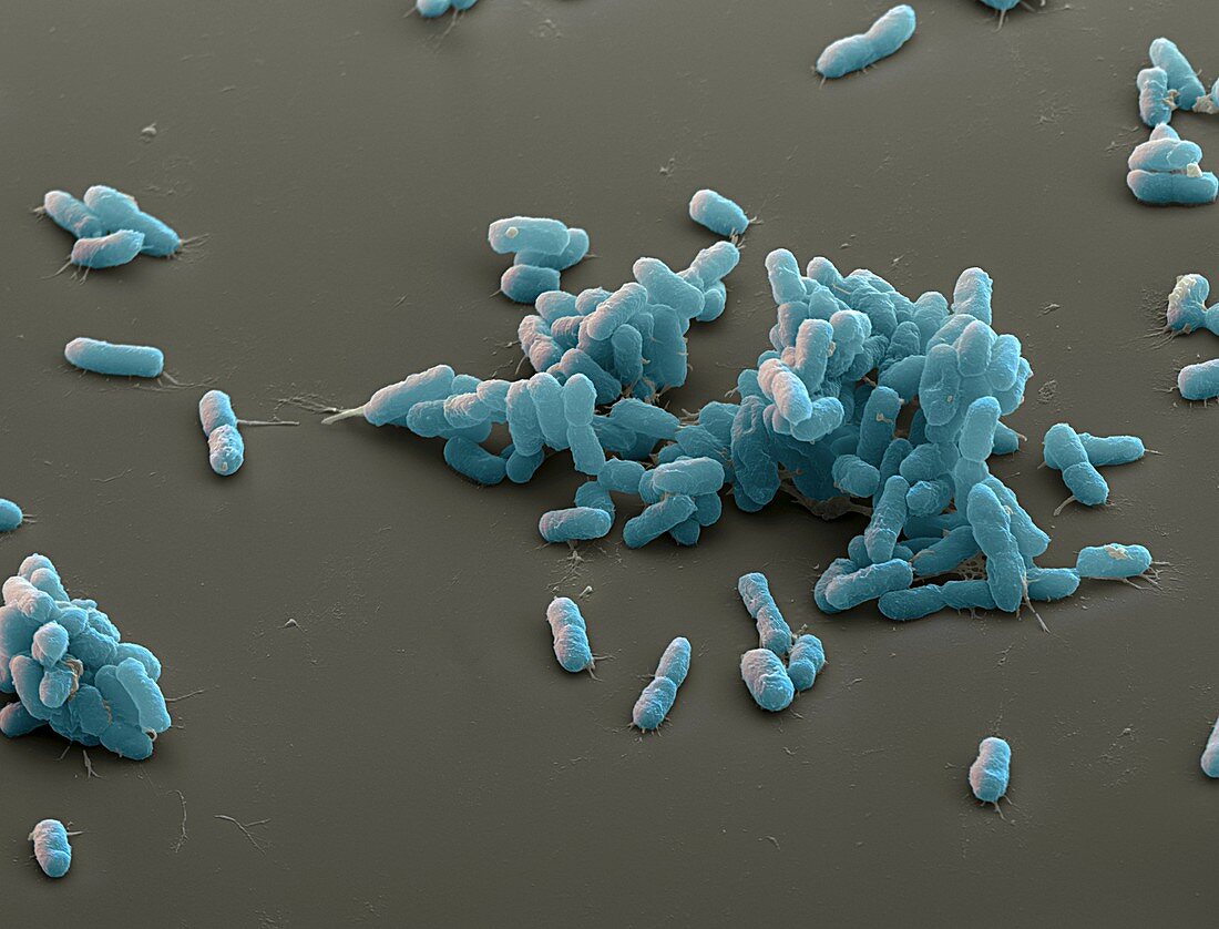 Yersinia pestis 7500x - Bakterien, Pesterreger, Yersinia pestis 7500-1