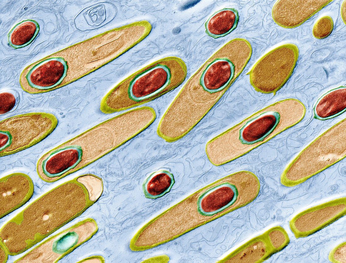 Bacillus anthracis, Milzbrand 14 000:1