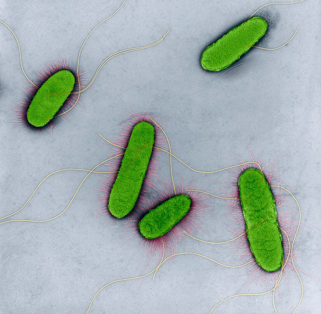 E coli 10kxTEM - Escherichia coli 10 000-1