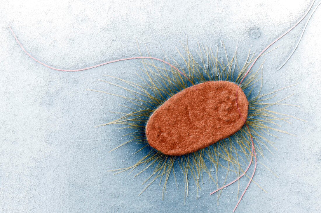 E coli 35kx TEM - Escherichia coli, 35 000-1