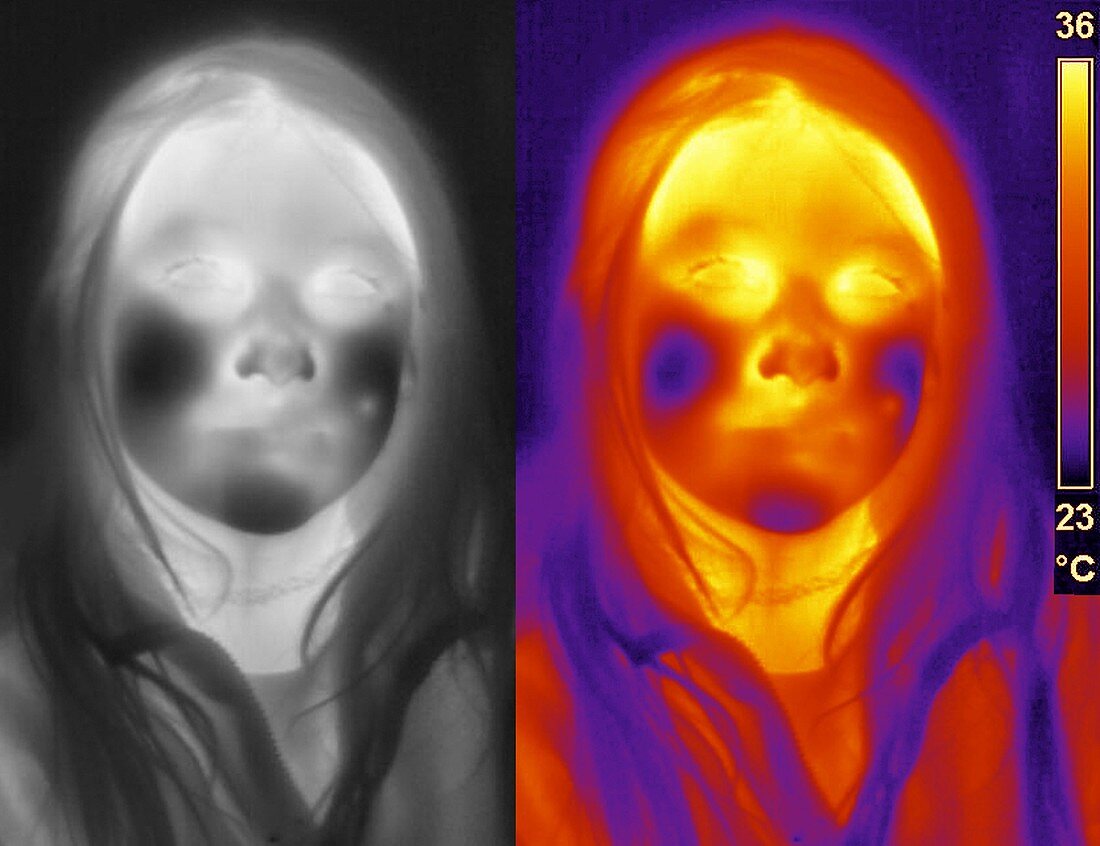 Girl's face, thermogram
