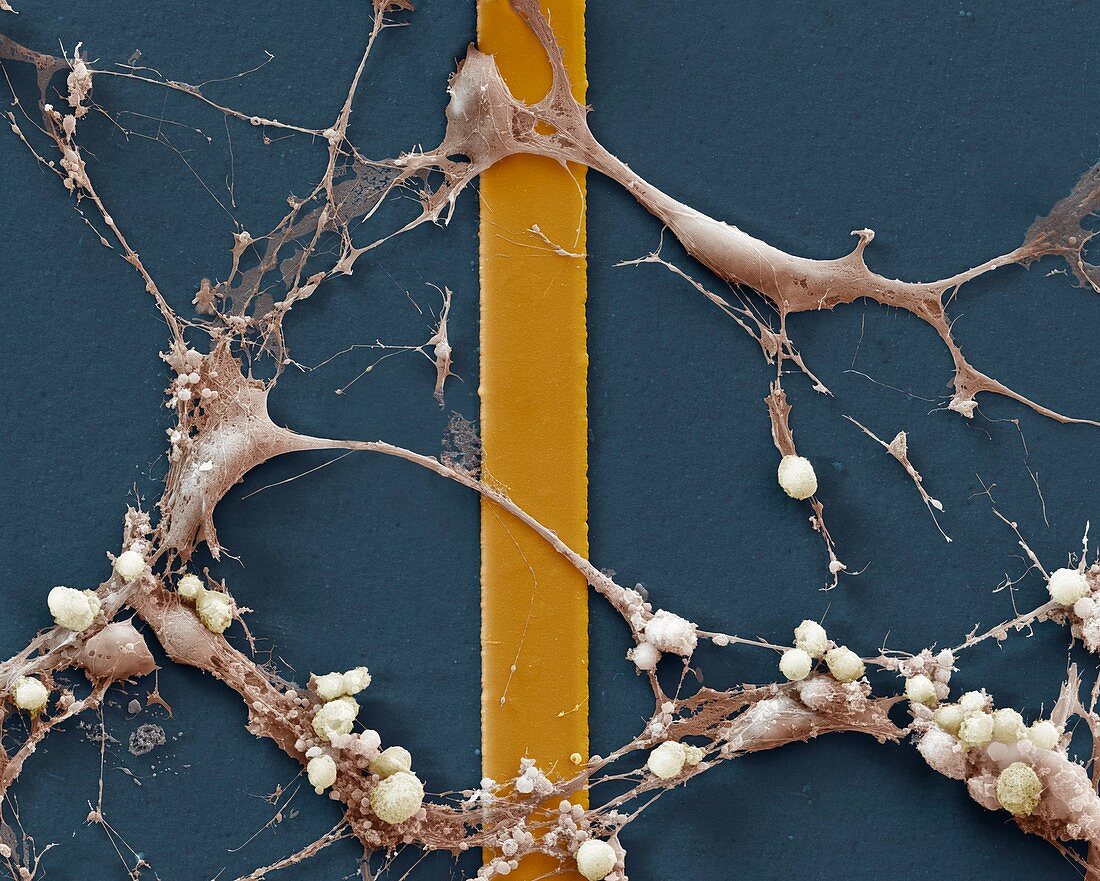 Nerve cells on silicon chip, SEM