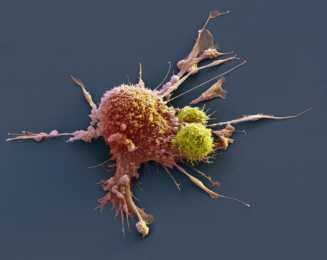 Cancer immunotherapy, SEM