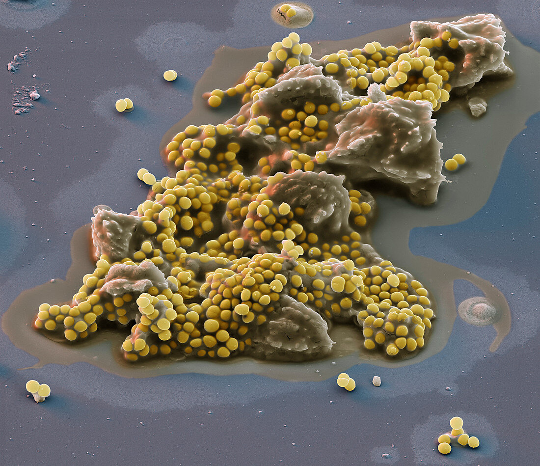 Staphylococcus lugdunensis 6000:1