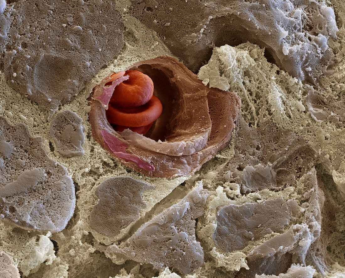 Capillary and red blood cells, SEM