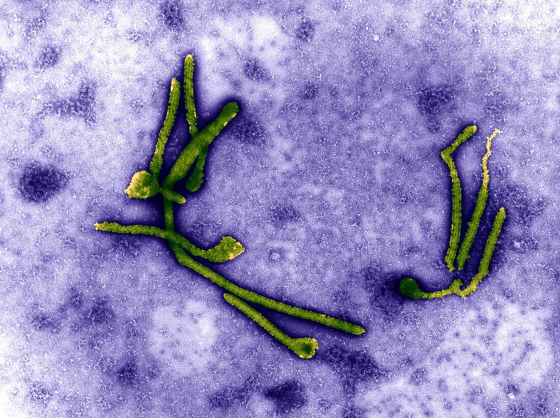 Coloured TEM of a number of Ebola viruses