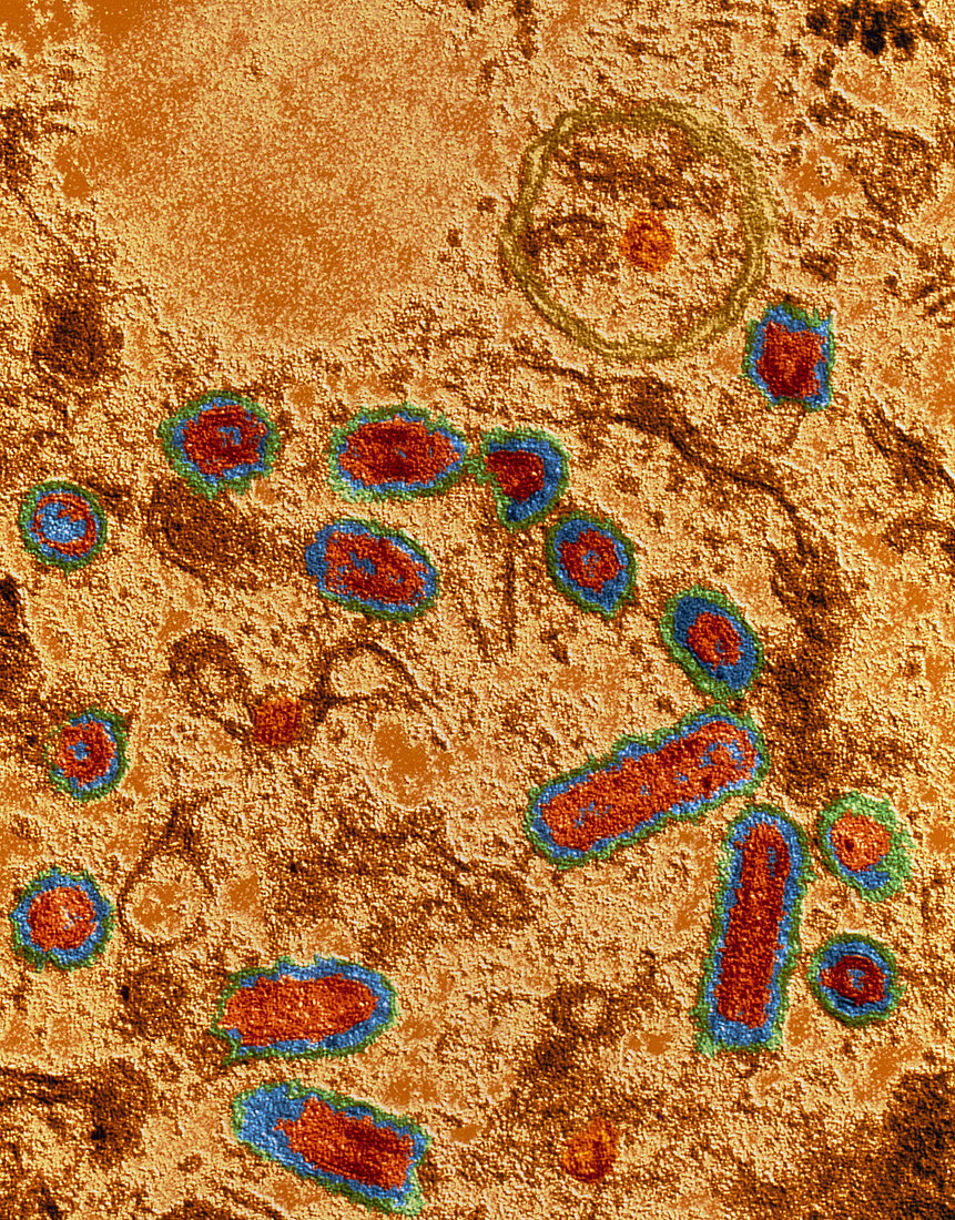 Coloured TEM of a rabies viruses infecting cell