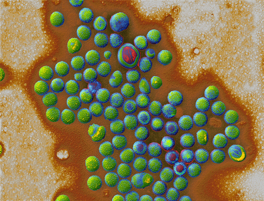 Coloured TEM of a group of rotaviruses