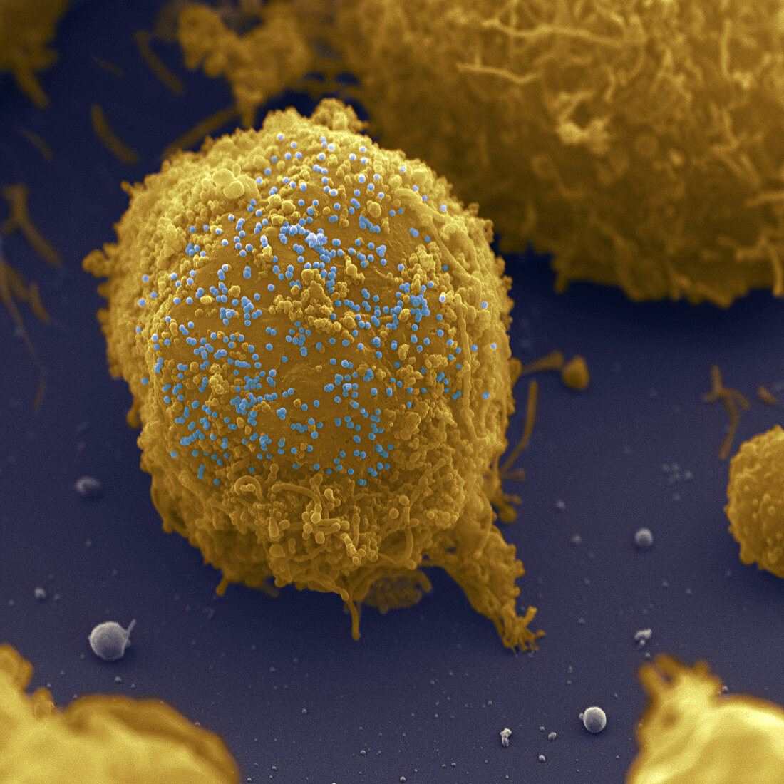 SEM of a T-cell infected with AIDS virus