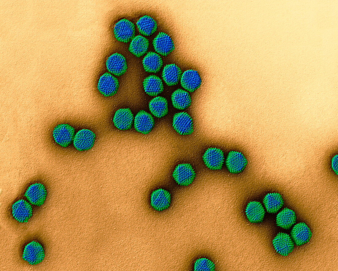 Adenoviruses, TEM