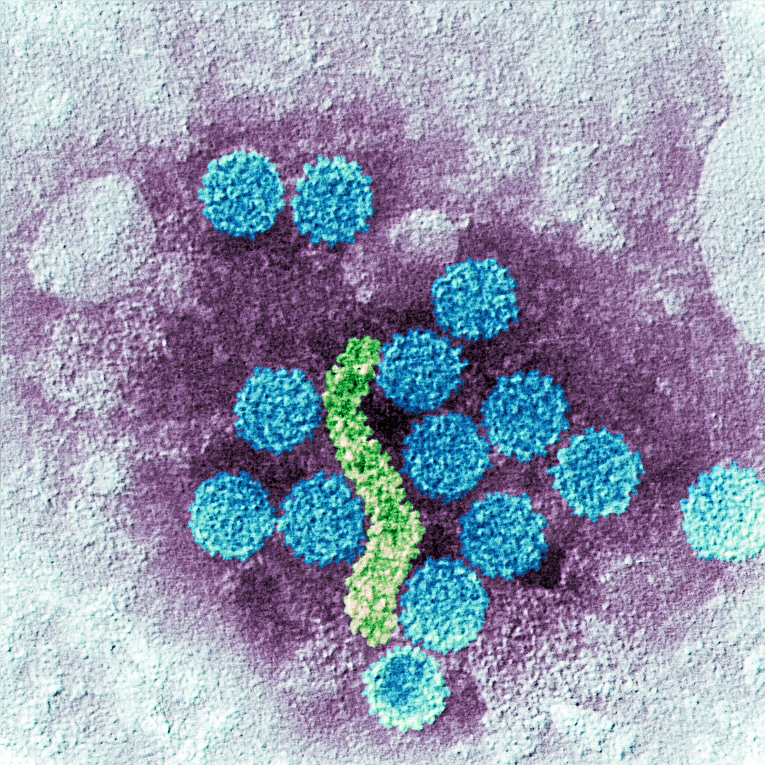 Papillomavirus virions, TEM