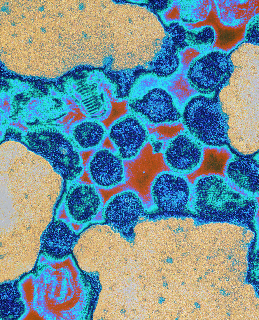 Coloured TEM of a cluster of influenza A viruses