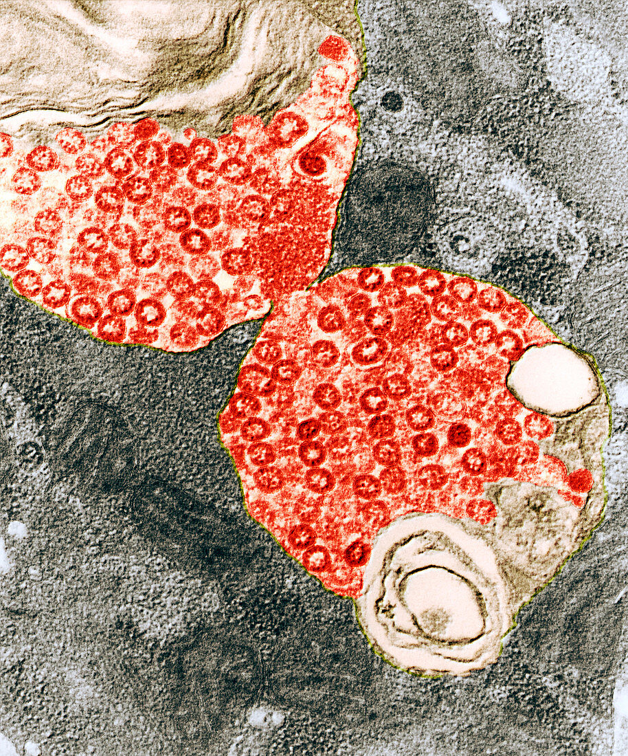 Vero SARS 70000x - Corona-Viren, SARS 70 000x