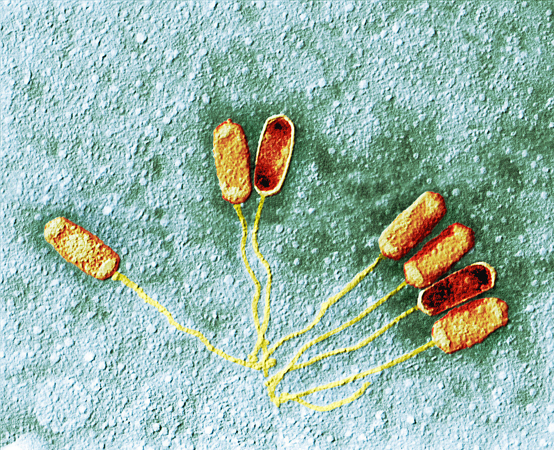 Bacteriophage virions, TEM