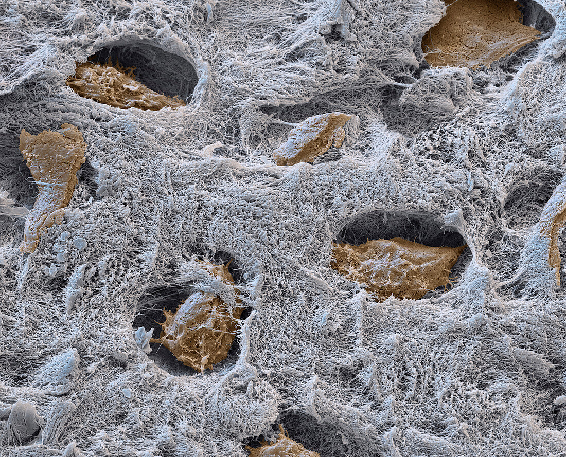 Cartilage cells and bone tissue, SEM