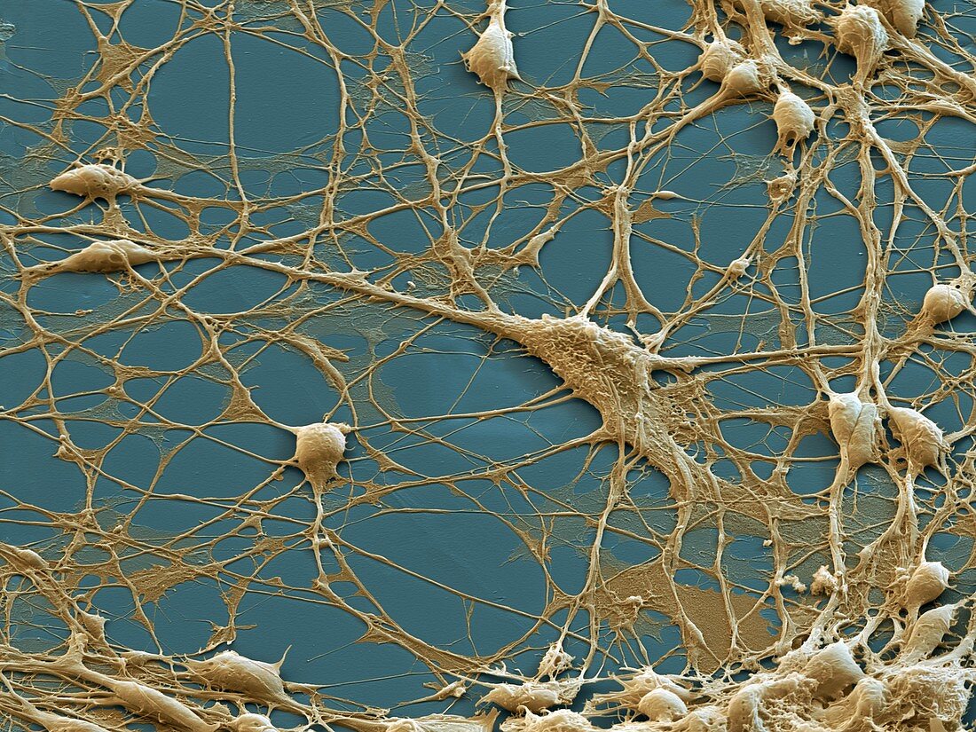 Neuronale Vorlaeuferzelle 1250x - Neuronale Vorläuferzellen, human (Neuronal Progenitor Cells) 1250x
