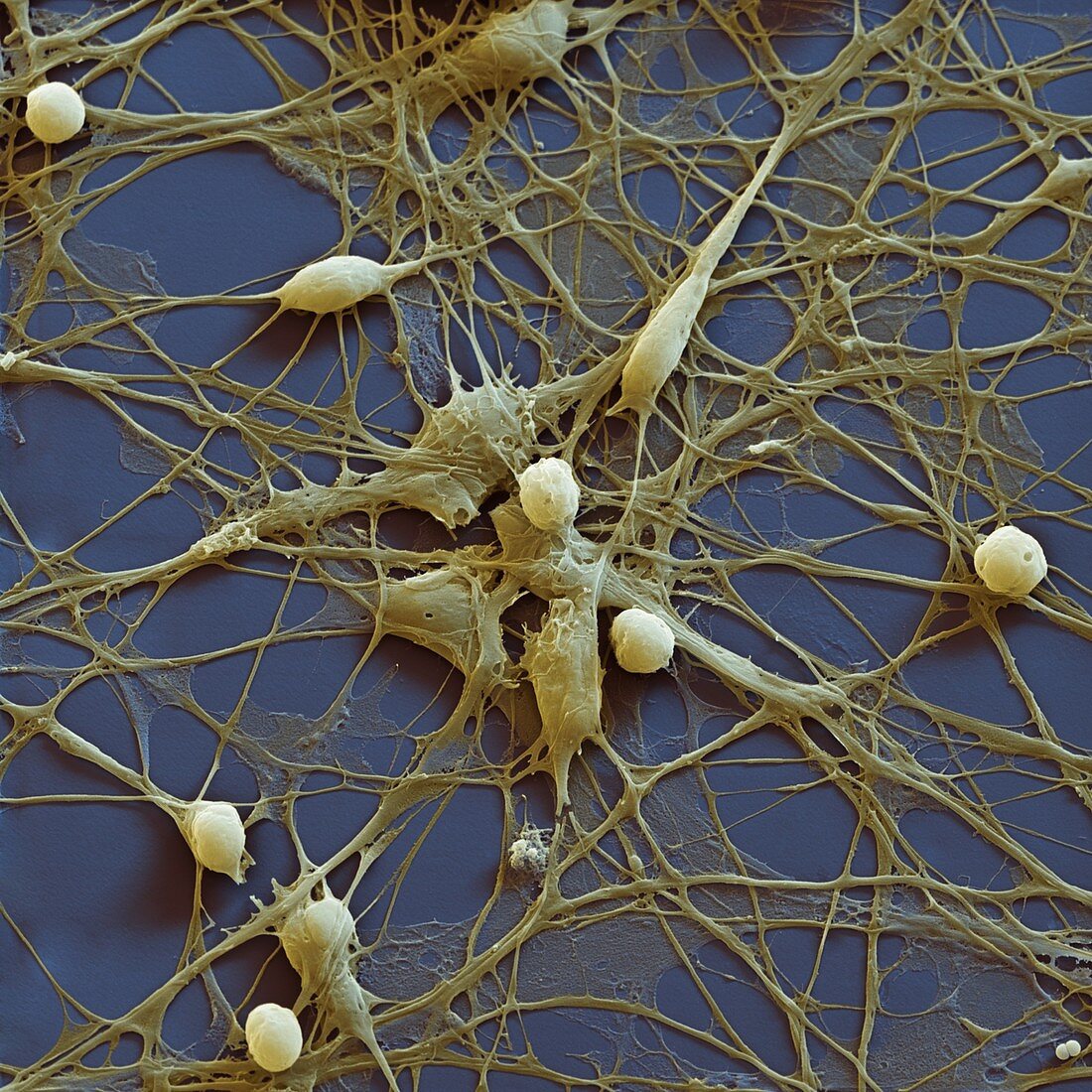 Neuronale Vorlaeuferzelle 1800x - Neuronale Vorläuferzellen, human (Neuronal Progenitor Cells) 1800x