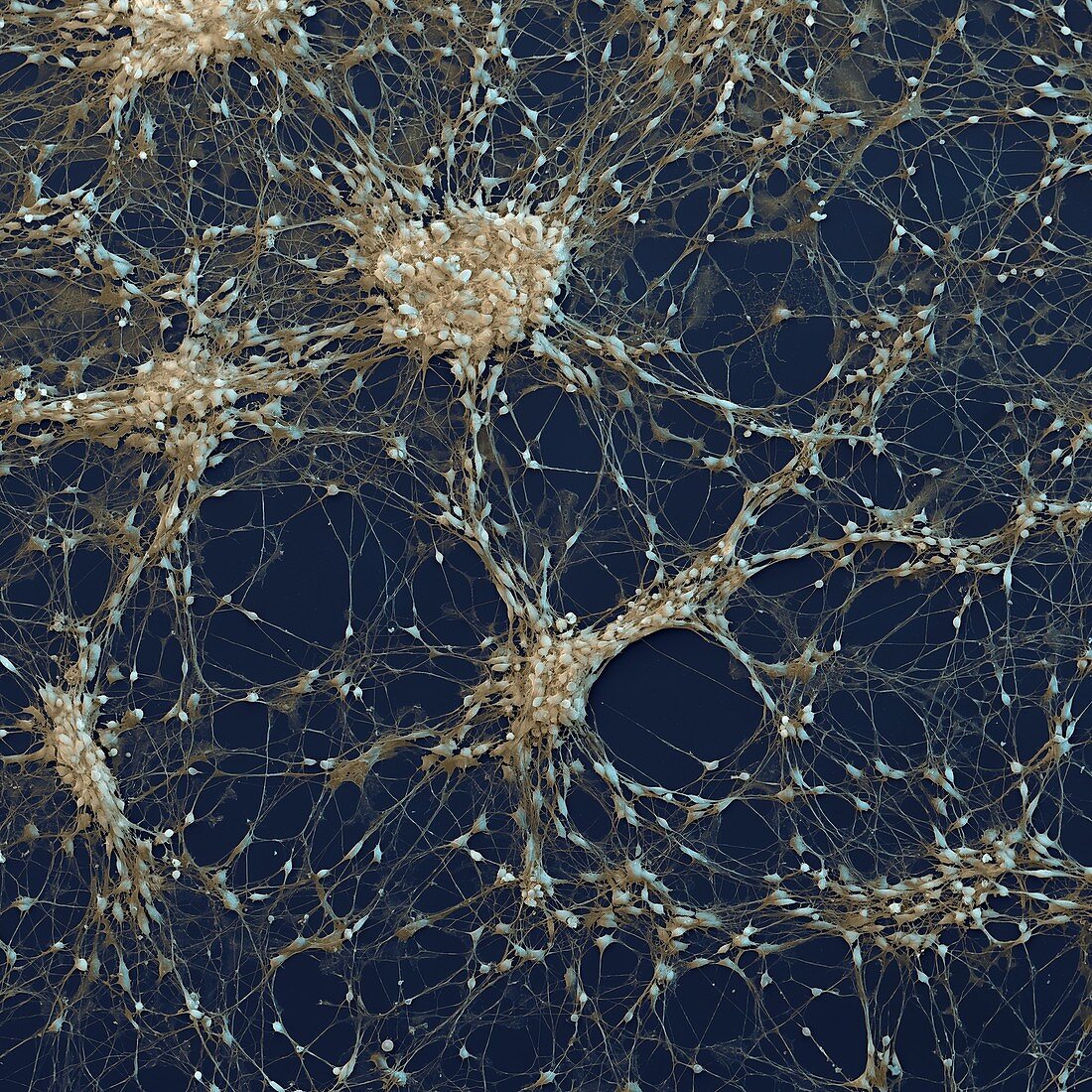Neural progenitor cells, SEM