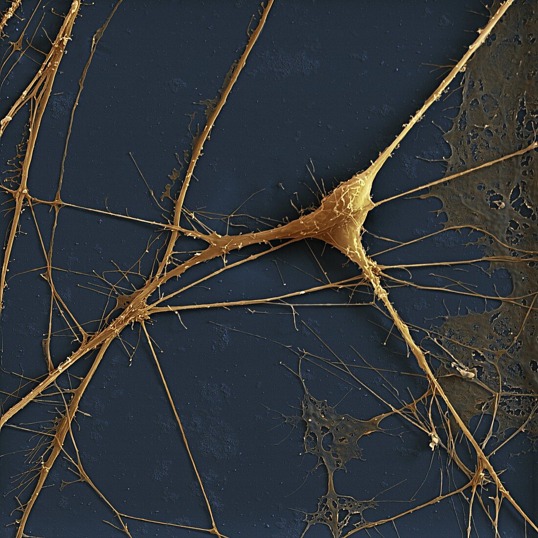Spinal ganglion nerve cells, SEM