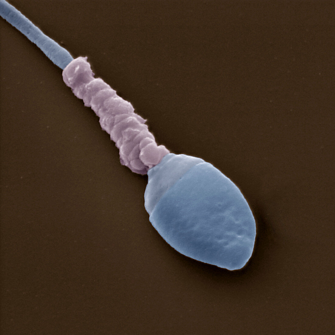 Sperm 12000x - Medizin, Mensch, Spermium