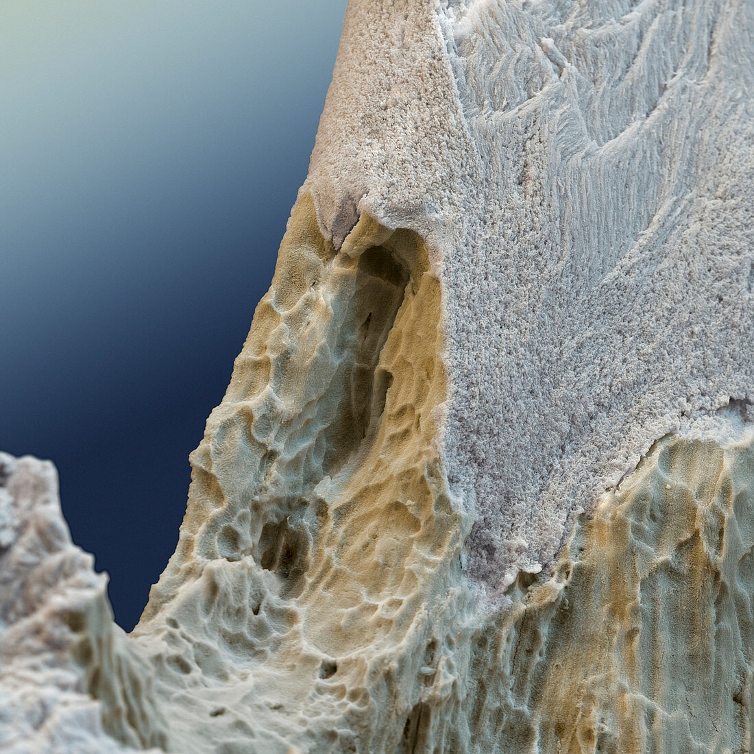 Knochen Osteoporose 440x - 