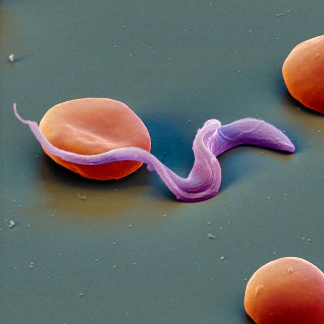Colour SEM of Trypansoma sp. protozoa in blood