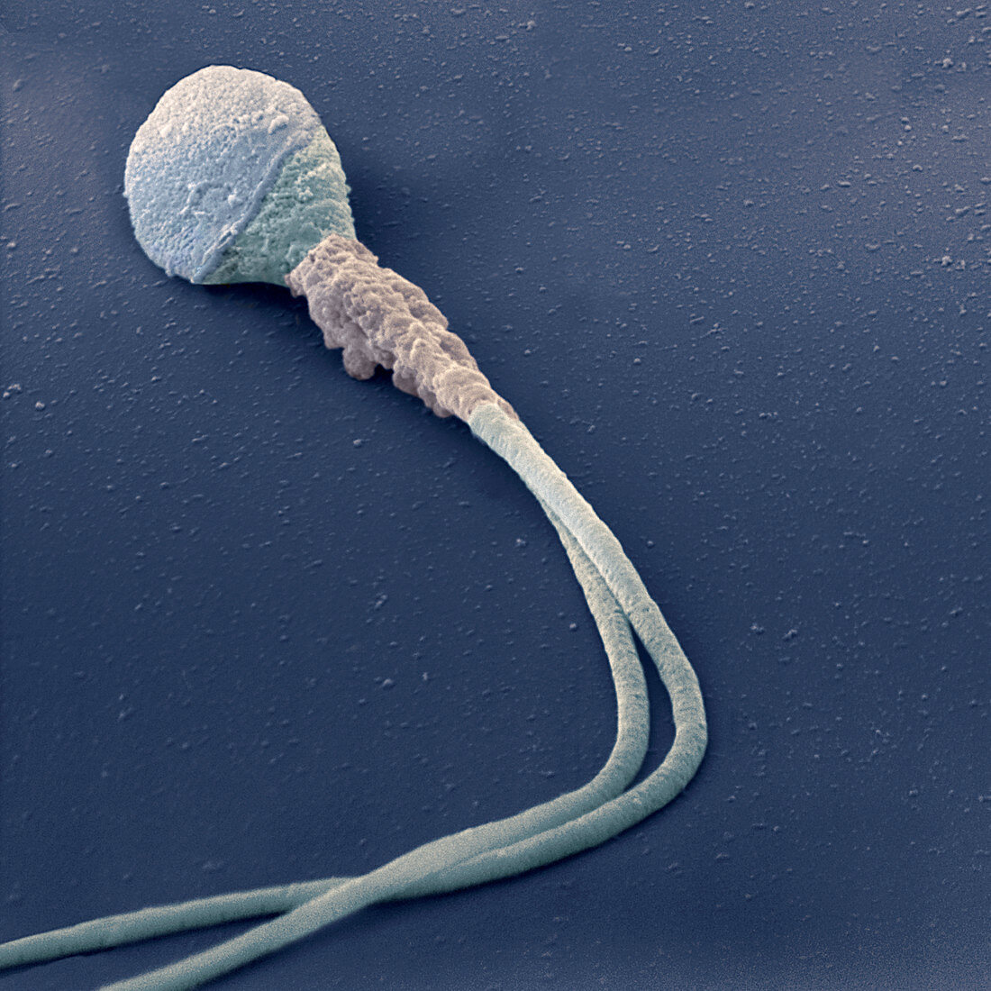 Sperm Doppelschw 8600x - Medizin, Mensch, Spermium