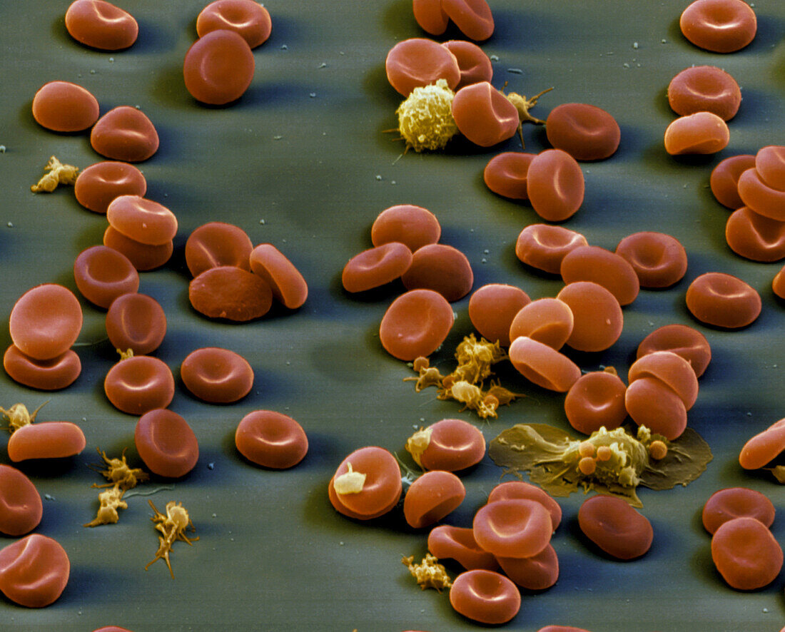 Colour SEM of red & white blood cells & platelets