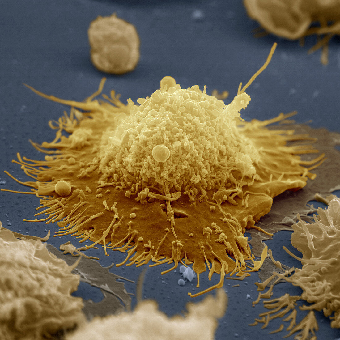 Coloured SEM of a B-lymphocyte white blood cell