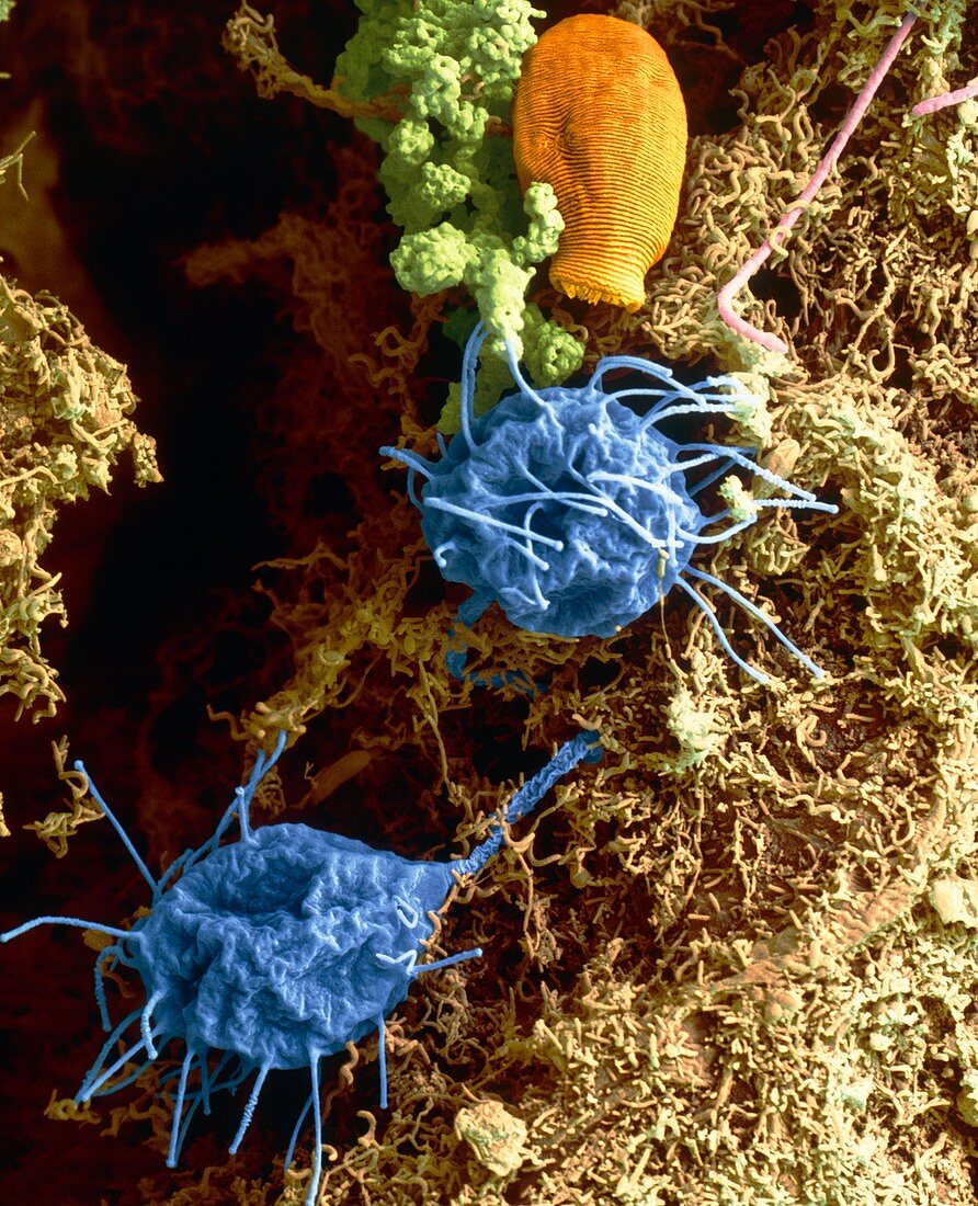 Col. SEM of yeast cells & ciliates in compost heap