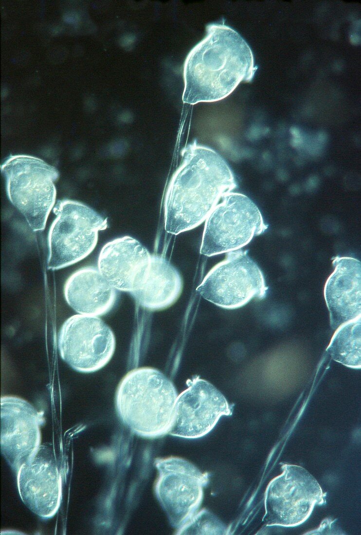 Vorticella protozoa, light micrograph