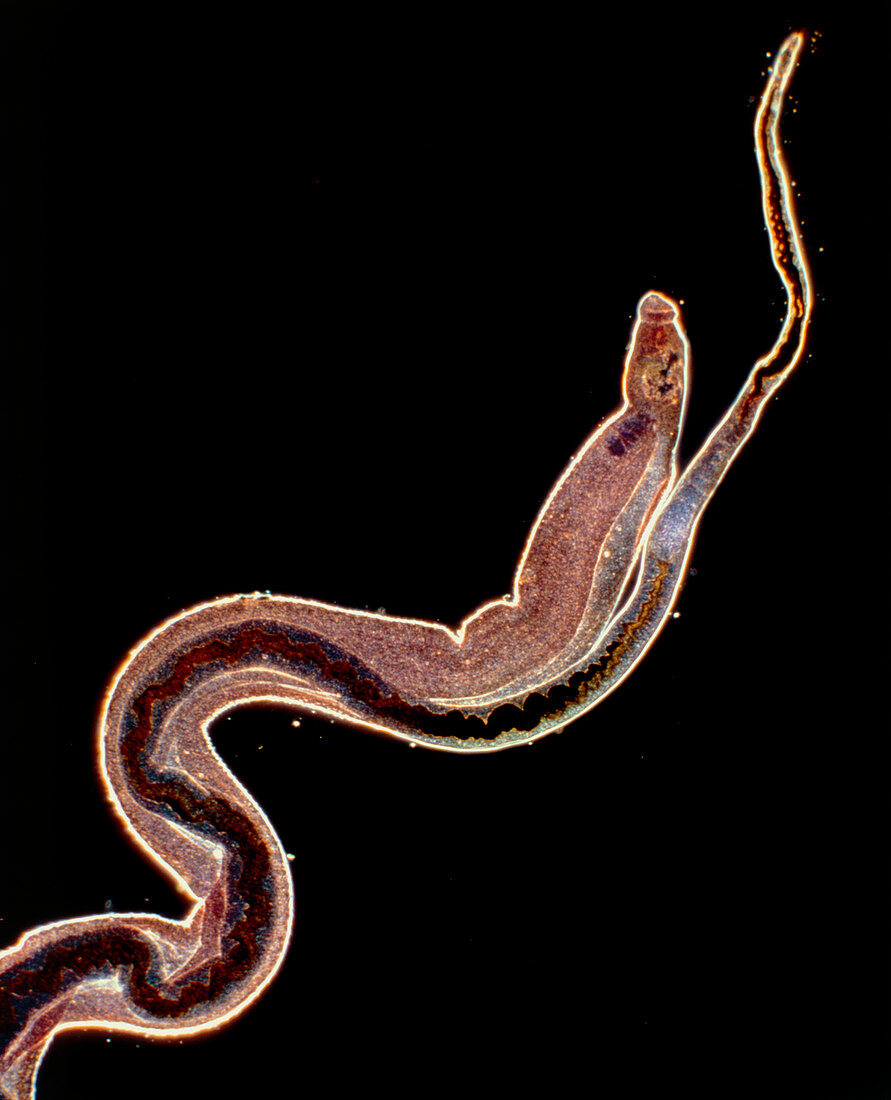 LM of an intestinal blood fluke, Schistosoma sp.