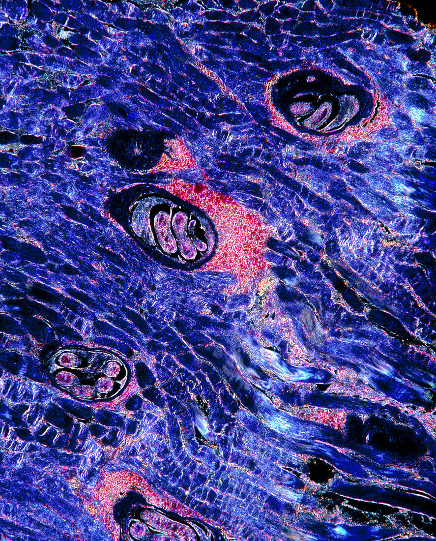 LM of cysts caused by Trichinella spiralis
