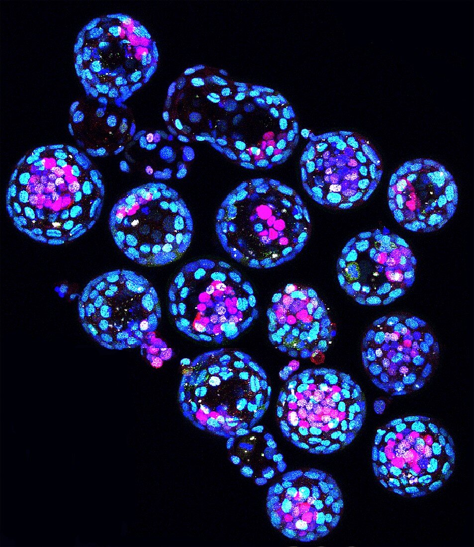 Mouse blastocysts, confocal micrograph