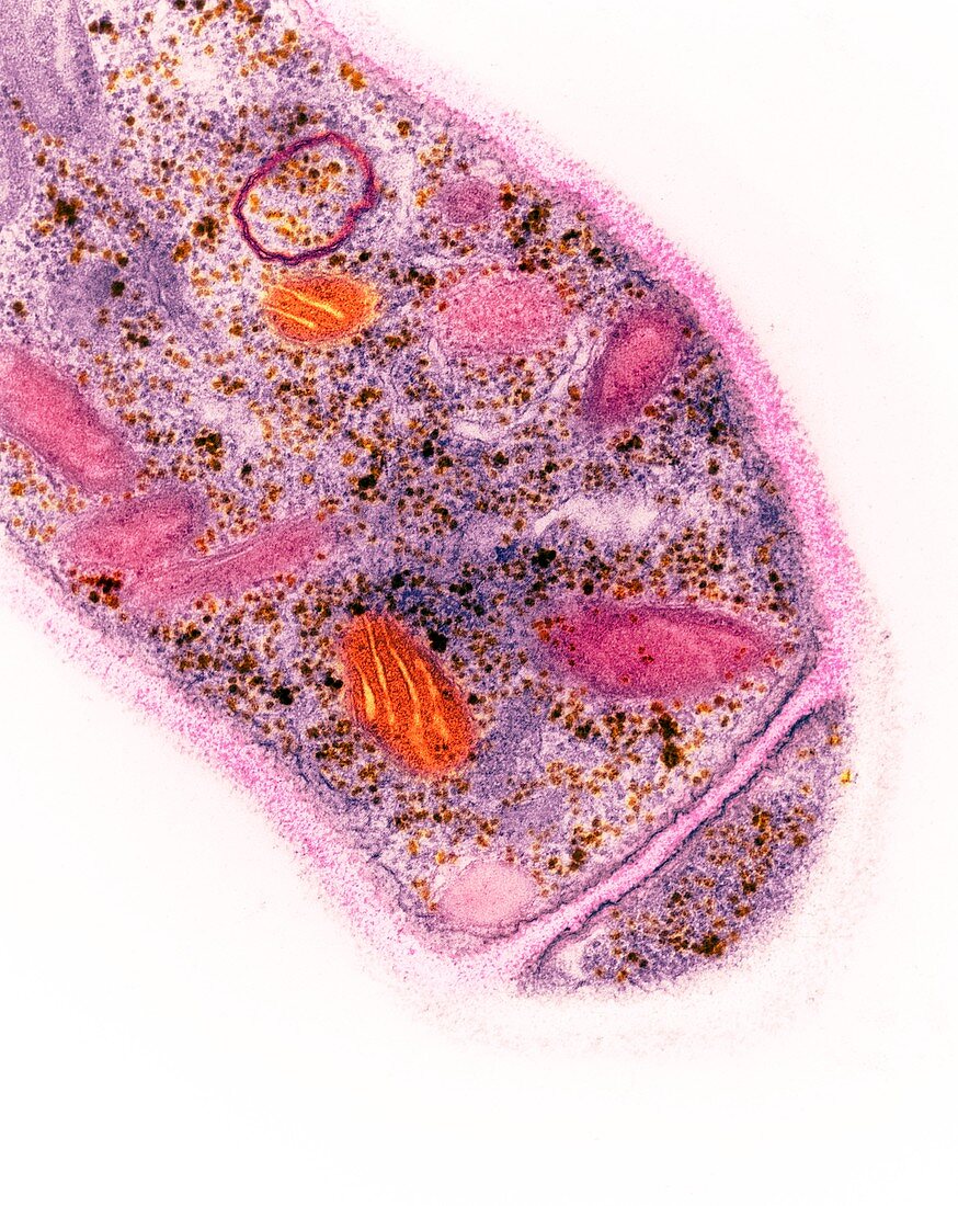 Trichoderma reesei fungus, TEM