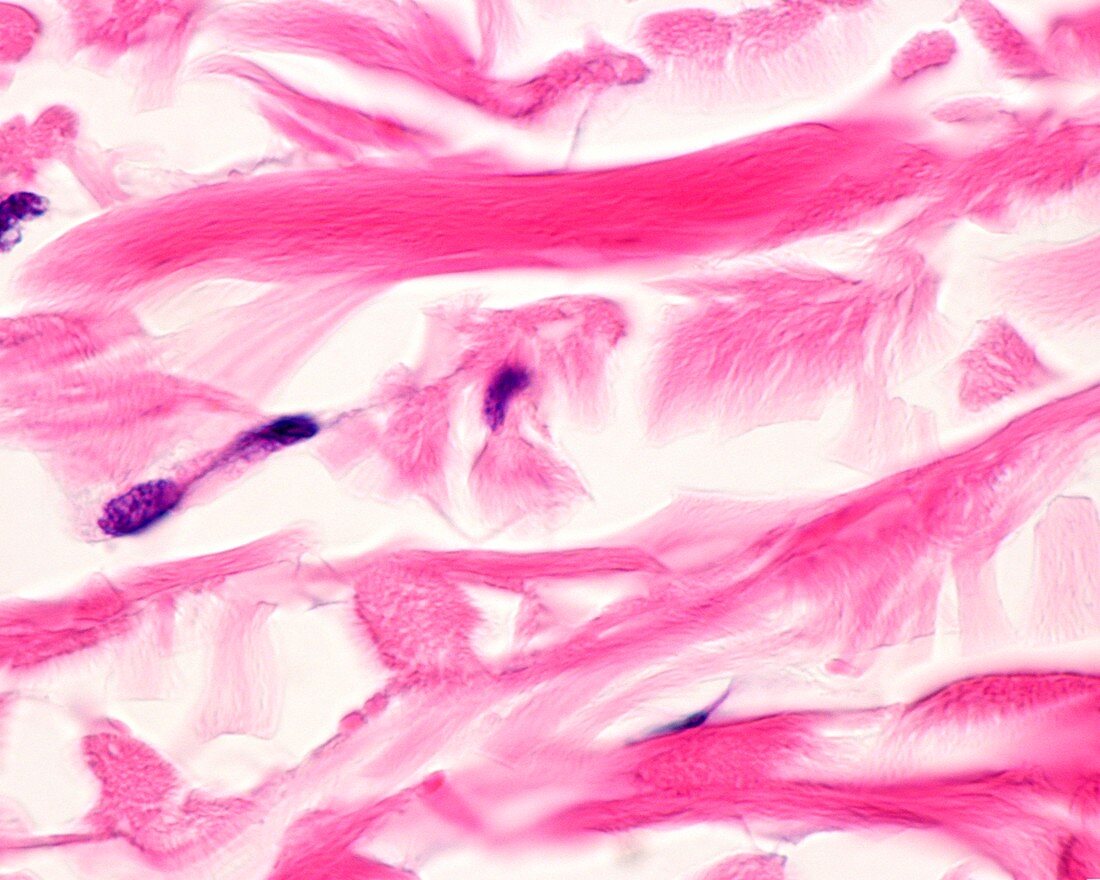 Skin collagen fibres, light micrograph