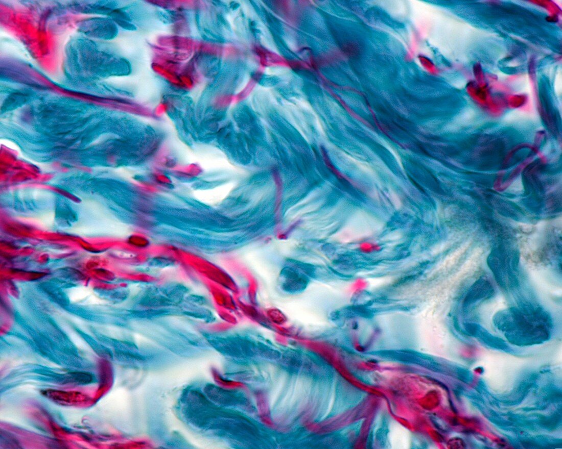 Skin collagen and elastic fibres, light micrograph