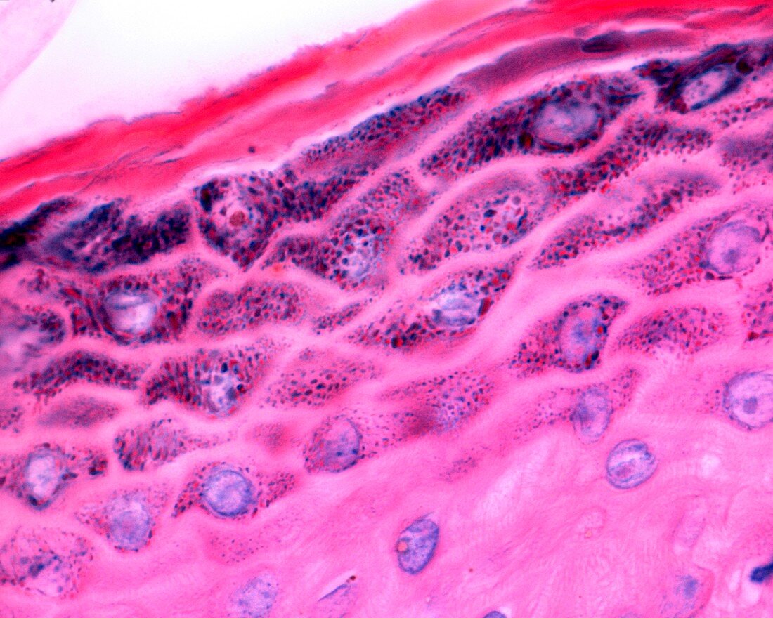 Skin, light micrograph