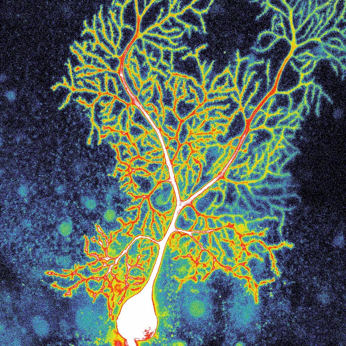 Purkinje nerve cell, confocal micrograph