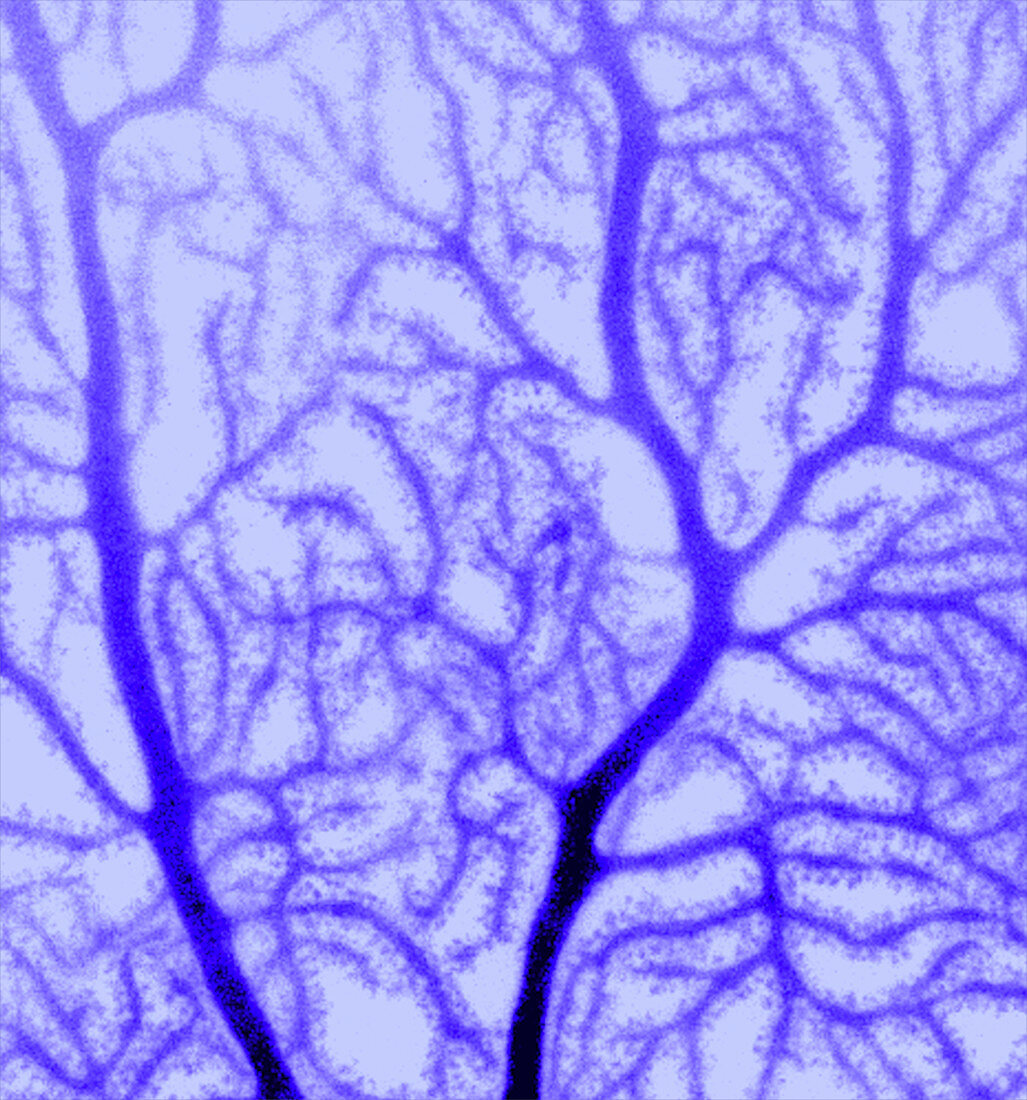 Purkinje nerve cell dendrites, confocal micrograph