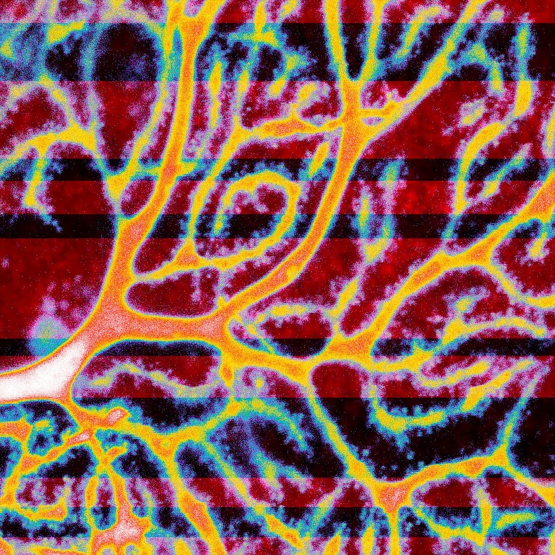 Purkinje nerve cell dendrites, confocal micrograph