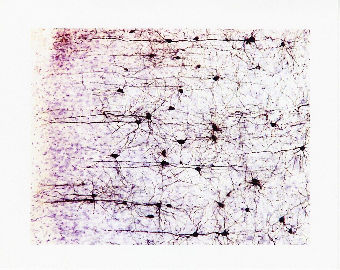 Brain cells and fibres, light micrograph