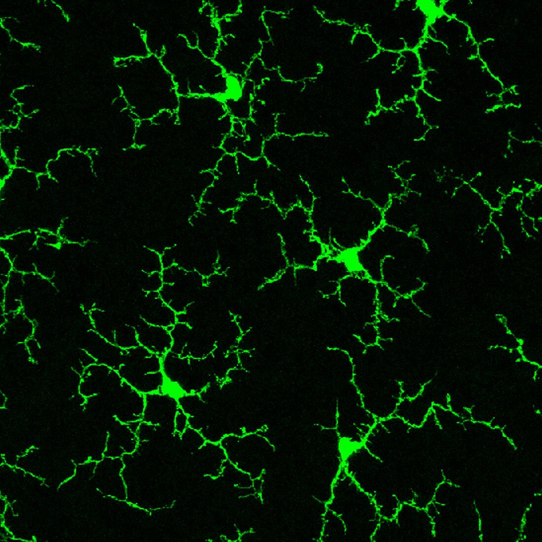 Microglia retina cells, fluorescence micrograph