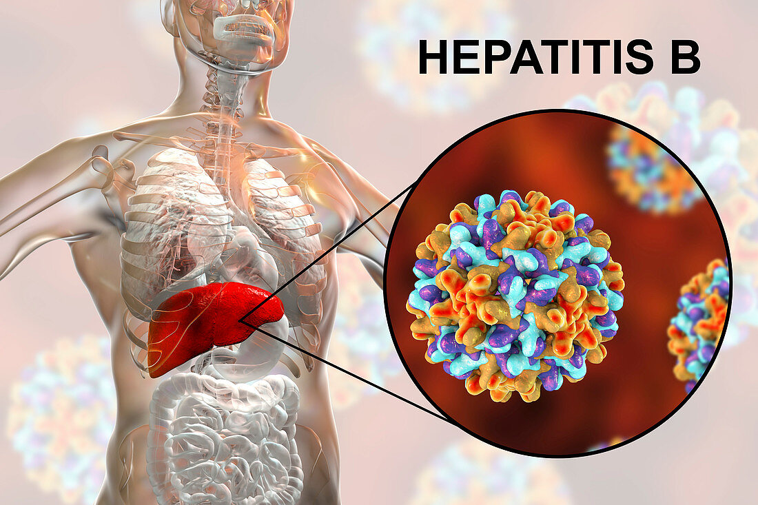 Hepatitis B infection, illustration