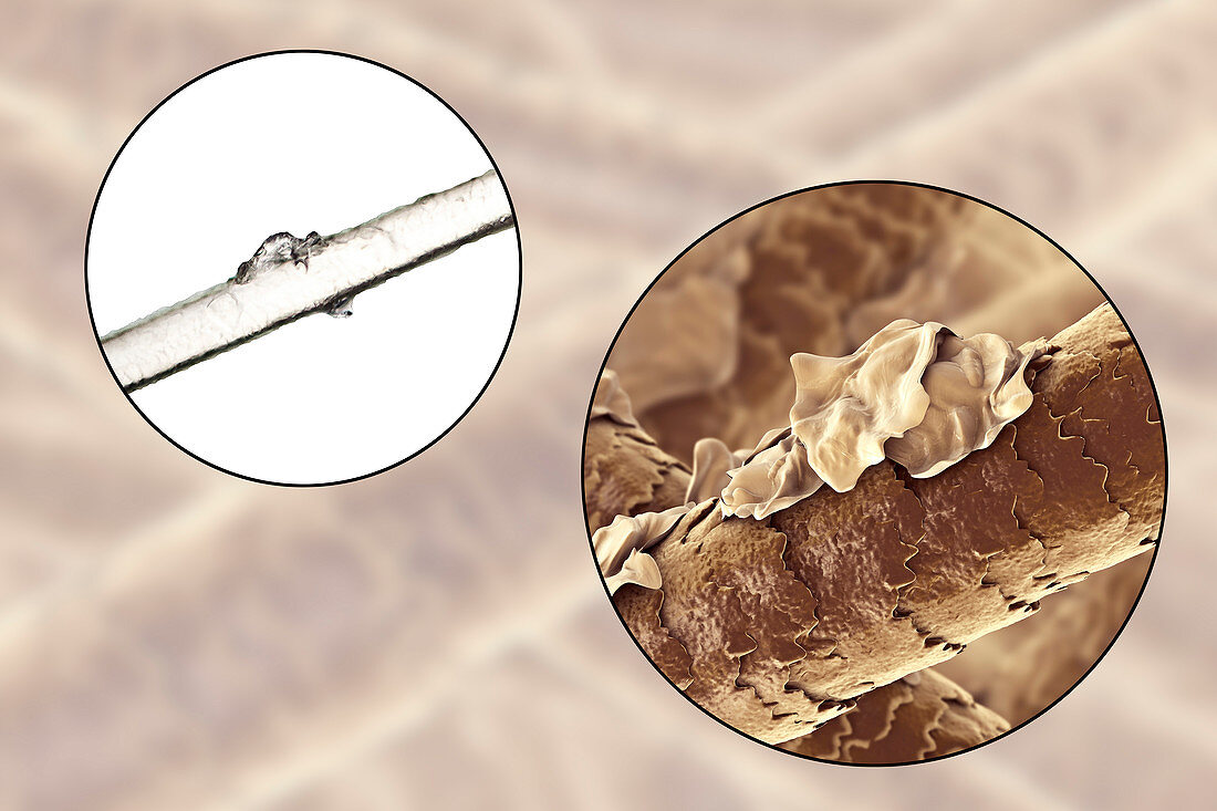 Human hair with dandruff, illustration and micrograph