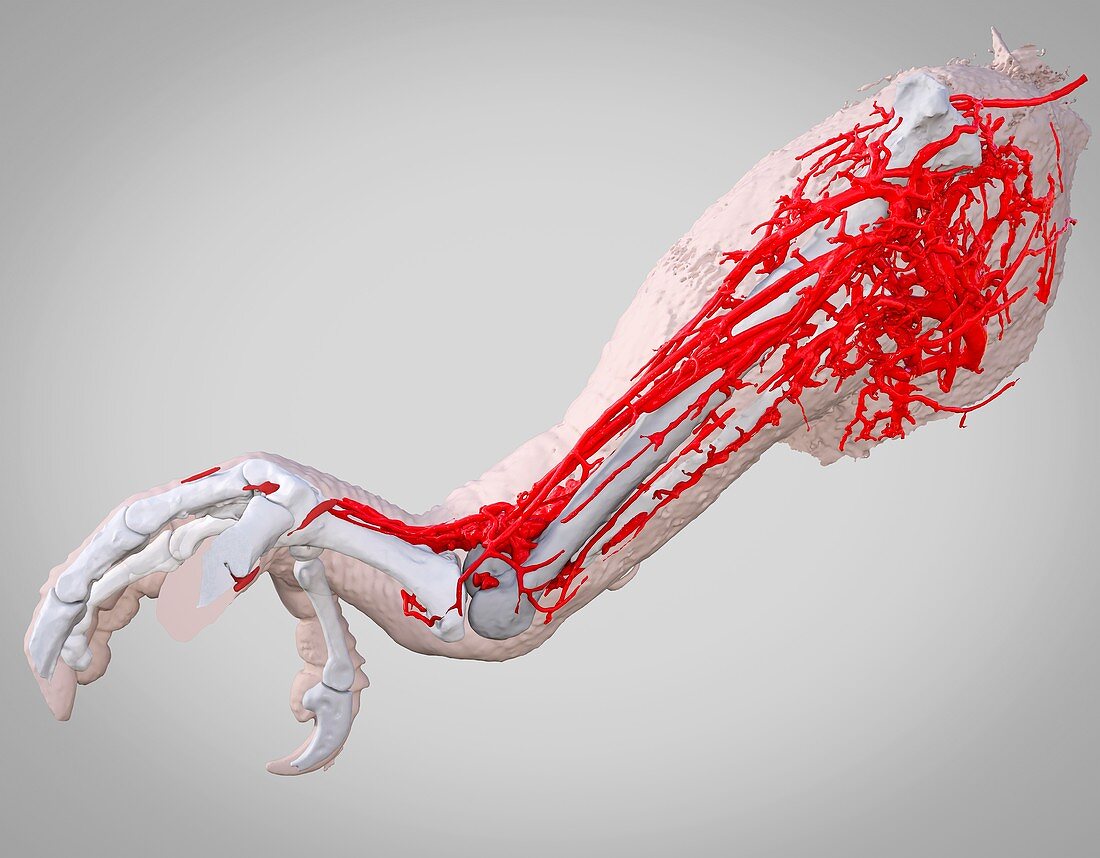 Parrot leg and blood vessels, 3D CT scan
