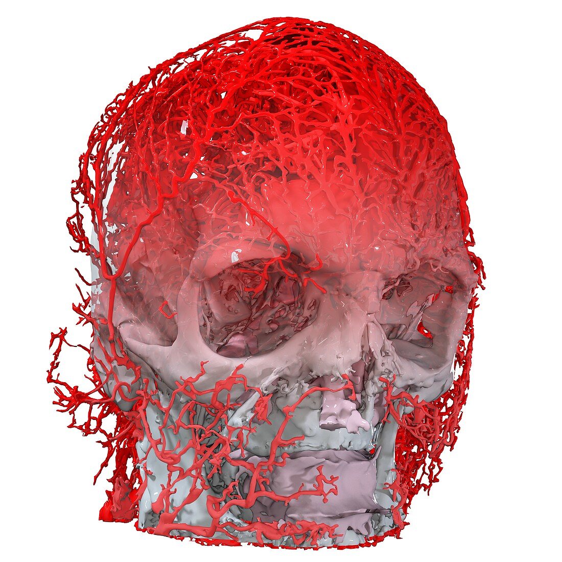 Human head and blood vessels, 3D CT scan